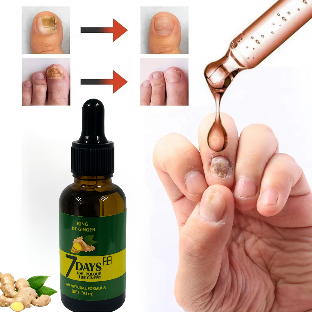 NailGrow Ginger – Uñas más fuertes en 7 días